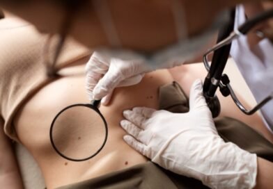 Câncer de pele mais comum no Brasil avança por falsa sensação de segurança, alerta especialista